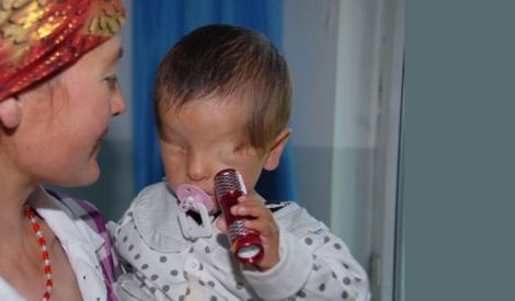 إمرأة صينية تضع طفلاً بدون عينين
